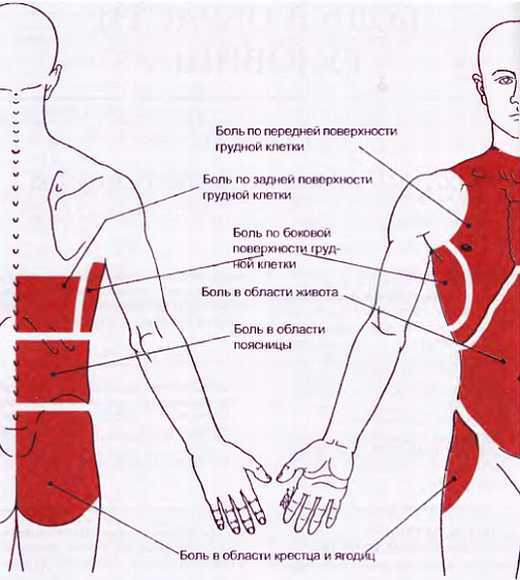 Миофасциальные боли и дисфункции. Руководство по триггерным точкам (в 2-х томах). Том 1. Верхняя половина туловища - _08.jpg_14