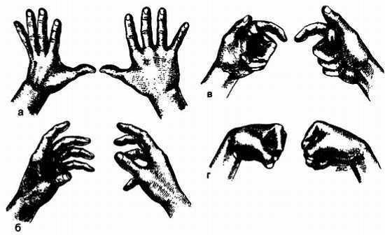 Миофасциальные боли и дисфункции. Руководство по триггерным точкам (в 2-х томах). Том 1. Верхняя половина туловища - _08.jpg_5