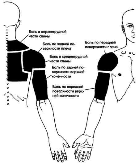 Миофасциальные боли и дисфункции. Руководство по триггерным точкам (в 2-х томах). Том 1. Верхняя половина туловища - _08.jpg_6