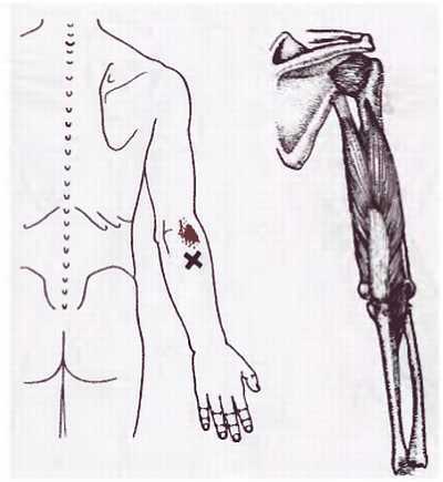 Миофасциальные боли и дисфункции. Руководство по триггерным точкам (в 2-х томах). Том 1. Верхняя половина туловища - _09.jpg_10