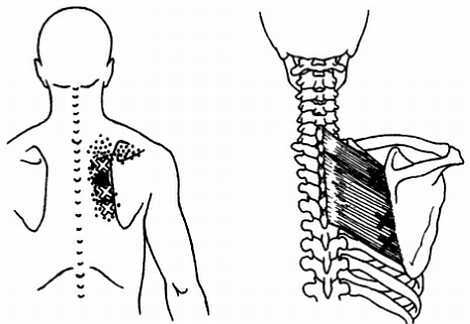 Миофасциальные боли и дисфункции. Руководство по триггерным точкам (в 2-х томах). Том 1. Верхняя половина туловища - _09.jpg_8