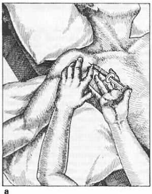 Миофасциальные боли и дисфункции. Руководство по триггерным точкам (в 2-х томах). Том 1. Верхняя половина туловища - _10.jpg_6