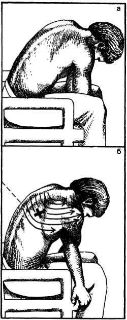 Миофасциальные боли и дисфункции. Руководство по триггерным точкам (в 2-х томах). Том 1. Верхняя половина туловища - _11.jpg_4