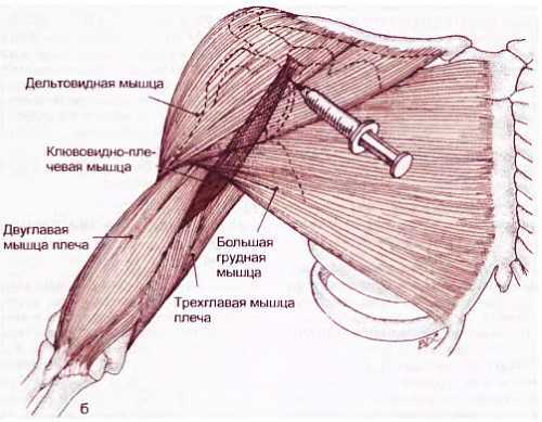 Миофасциальные боли и дисфункции. Руководство по триггерным точкам (в 2-х томах). Том 1. Верхняя половина туловища - _11.jpg_5