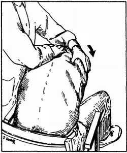 Миофасциальные боли и дисфункции. Руководство по триггерным точкам (в 2-х томах). Том 1. Верхняя половина туловища - _12.jpg_2