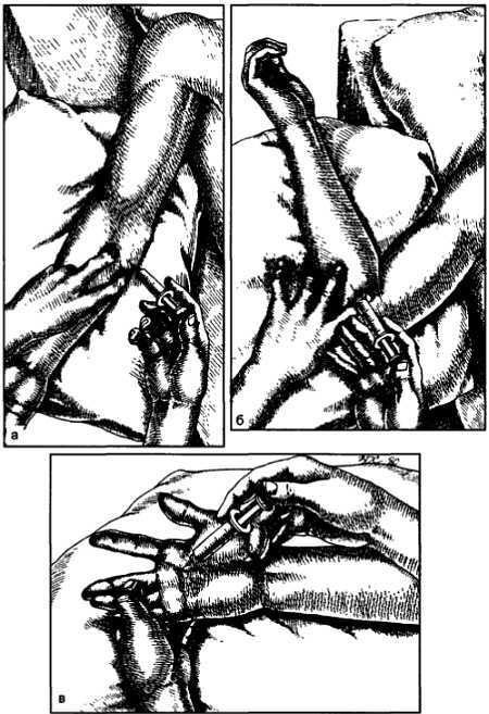 Миофасциальные боли и дисфункции. Руководство по триггерным точкам (в 2-х томах). Том 1. Верхняя половина туловища - _13.jpg_4