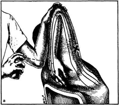 Миофасциальные боли и дисфункции. Руководство по триггерным точкам (в 2-х томах). Том 1. Верхняя половина туловища - _14.jpg_1