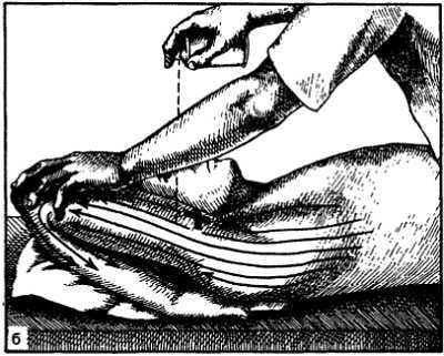 Миофасциальные боли и дисфункции. Руководство по триггерным точкам (в 2-х томах). Том 1. Верхняя половина туловища - _15.jpg_1