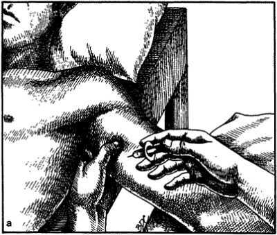 Миофасциальные боли и дисфункции. Руководство по триггерным точкам (в 2-х томах). Том 1. Верхняя половина туловища - _16.jpg_1