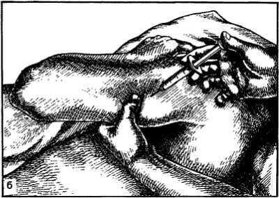 Миофасциальные боли и дисфункции. Руководство по триггерным точкам (в 2-х томах). Том 1. Верхняя половина туловища - _17.jpg_0