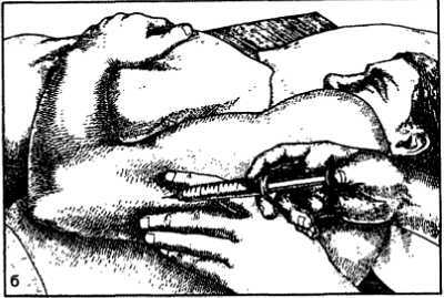 Миофасциальные боли и дисфункции. Руководство по триггерным точкам (в 2-х томах). Том 1. Верхняя половина туловища - _19.jpg_0