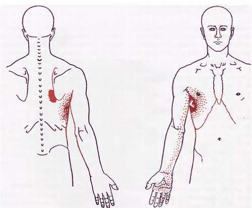 Миофасциальные боли и дисфункции. Руководство по триггерным точкам (в 2-х томах). Том 1. Верхняя половина туловища - _00.jpg_50