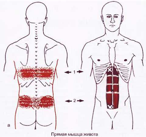 Миофасциальные боли и дисфункции. Руководство по триггерным точкам (в 2-х томах). Том 1. Верхняя половина туловища - _00.jpg_52