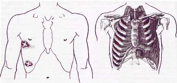 Миофасциальные боли и дисфункции. Руководство по триггерным точкам (в 2-х томах). Том 1. Верхняя половина туловища - _01.jpg_42