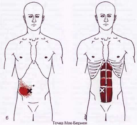 Миофасциальные боли и дисфункции. Руководство по триггерным точкам (в 2-х томах). Том 1. Верхняя половина туловища - _01.jpg_45