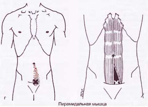 Миофасциальные боли и дисфункции. Руководство по триггерным точкам (в 2-х томах). Том 1. Верхняя половина туловища - _03.jpg_41