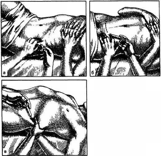 Миофасциальные боли и дисфункции. Руководство по триггерным точкам (в 2-х томах). Том 1. Верхняя половина туловища - _03.jpg_42