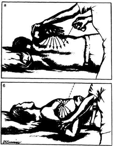 Миофасциальные боли и дисфункции. Руководство по триггерным точкам (в 2-х томах). Том 1. Верхняя половина туловища - _04.jpg_38