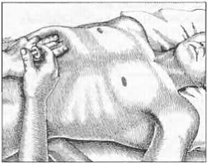 Миофасциальные боли и дисфункции. Руководство по триггерным точкам (в 2-х томах). Том 1. Верхняя половина туловища - _04.jpg_42