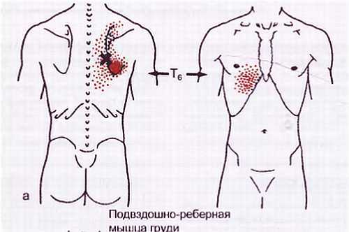 Миофасциальные боли и дисфункции. Руководство по триггерным точкам (в 2-х томах). Том 1. Верхняя половина туловища - _05.jpg_32