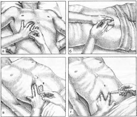 Миофасциальные боли и дисфункции. Руководство по триггерным точкам (в 2-х томах). Том 1. Верхняя половина туловища - _05.jpg_34