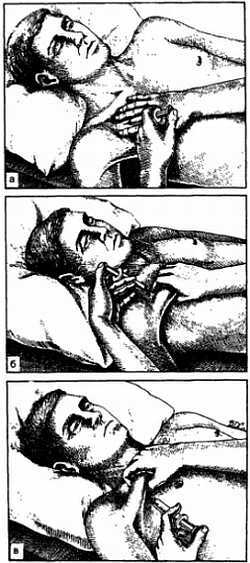 Миофасциальные боли и дисфункции. Руководство по триггерным точкам (в 2-х томах). Том 1. Верхняя половина туловища - _06.jpg_28