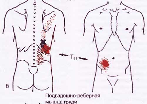 Миофасциальные боли и дисфункции. Руководство по триггерным точкам (в 2-х томах). Том 1. Верхняя половина туловища - _06.jpg_31