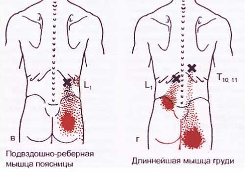 Миофасциальные боли и дисфункции. Руководство по триггерным точкам (в 2-х томах). Том 1. Верхняя половина туловища - _07.jpg_24