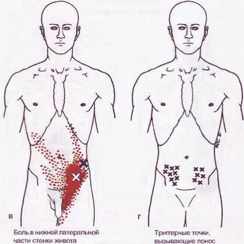 Миофасциальные боли и дисфункции. Руководство по триггерным точкам (в 2-х томах). Том 1. Верхняя половина туловища - _23.jpg_0