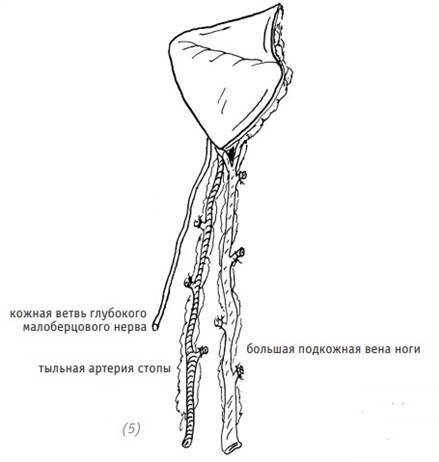 Атлас по оперативной хирургии верхней конечности - _170.jpg