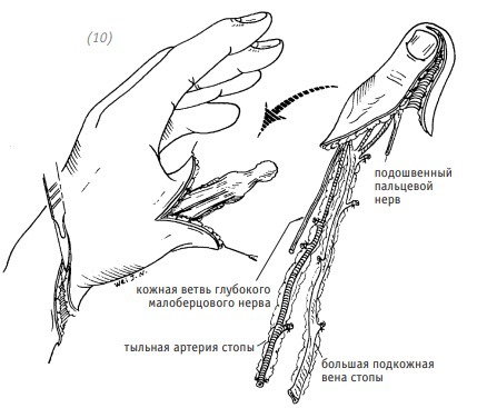 Атлас по оперативной хирургии верхней конечности - _187.jpg