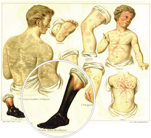 Нулевой пациент. Нестрашная история самых страшных болезней в мире - i_009.jpg