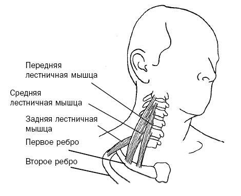 Синдром «замороженного» плеча. Терапия триггерных точек для преодоления боли и восстановления диапазона движений - i_027.jpg