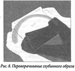 Практика психической защиты. Понимание и преодоление невидимых влияний - i_008.jpg