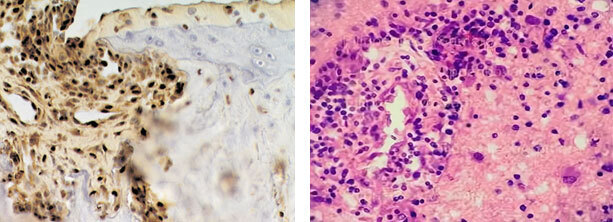 Клеточные и молекулярные механизмы патогенеза иммуновоспалительных ревматических заболеваний - i_007.jpg