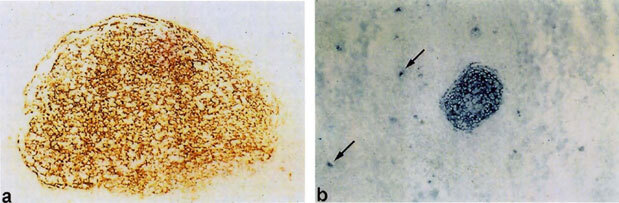 Клеточные и молекулярные механизмы патогенеза иммуновоспалительных ревматических заболеваний - i_008.jpg