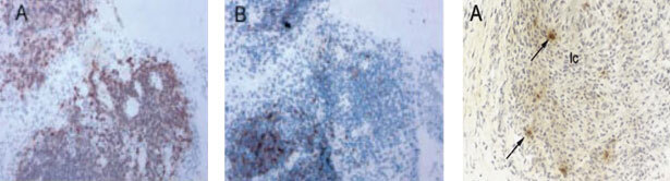 Клеточные и молекулярные механизмы патогенеза иммуновоспалительных ревматических заболеваний - i_009.jpg