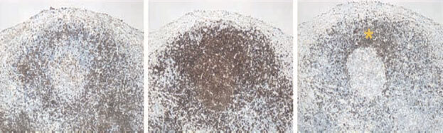 Клеточные и молекулярные механизмы патогенеза иммуновоспалительных ревматических заболеваний - i_010.jpg