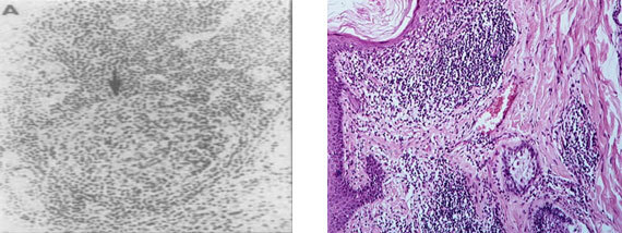 Клеточные и молекулярные механизмы патогенеза иммуновоспалительных ревматических заболеваний - i_011.jpg