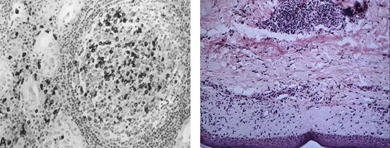 Клеточные и молекулярные механизмы патогенеза иммуновоспалительных ревматических заболеваний - i_012.jpg