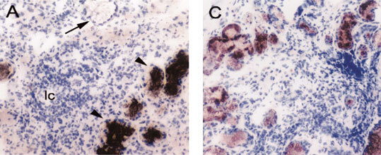 Клеточные и молекулярные механизмы патогенеза иммуновоспалительных ревматических заболеваний - i_013.jpg