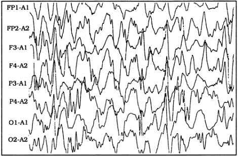 Психиатрическая клиника: Учебное пособие для студентов и врачей-интернов - _02.jpg_2
