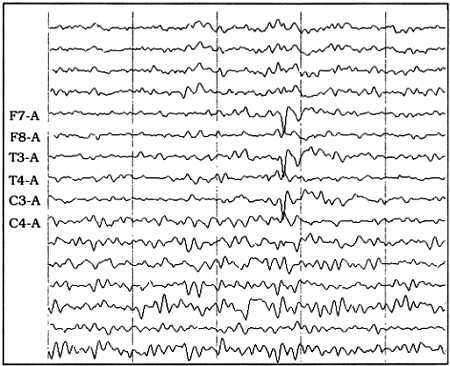 Психиатрическая клиника: Учебное пособие для студентов и врачей-интернов - _07.jpg_0