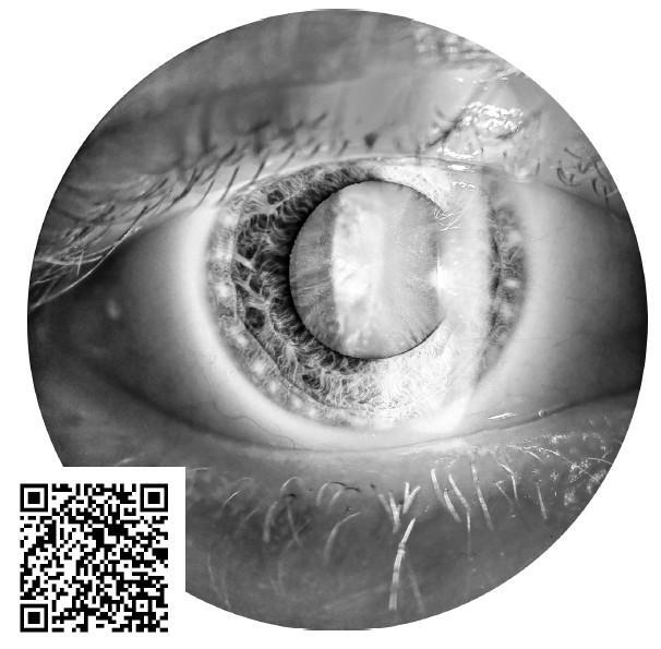 Видеть лучше. Как сохранить зрение : истории из кабинета офтальмолога - i_002.jpg