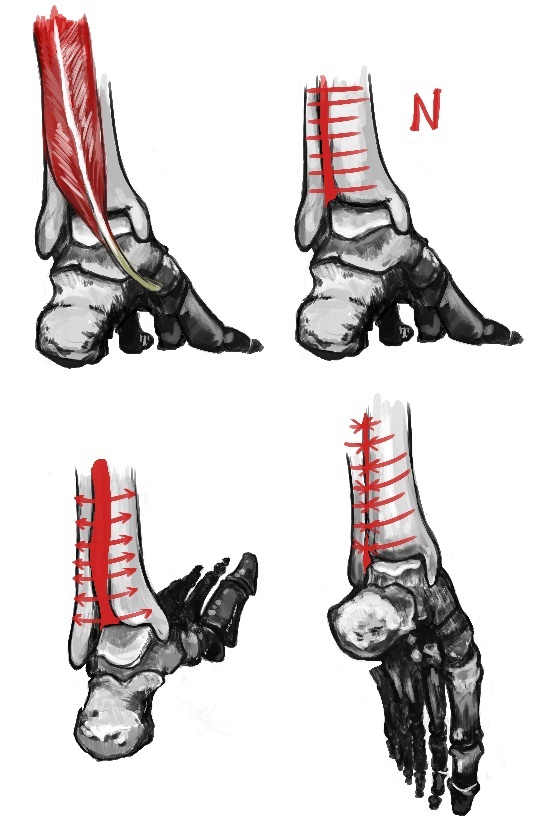 Стопа балерины - _19.jpg