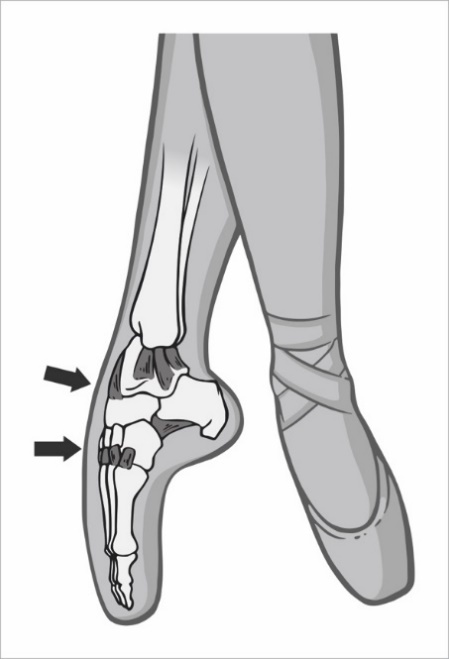 Стопа балерины - _24.jpg