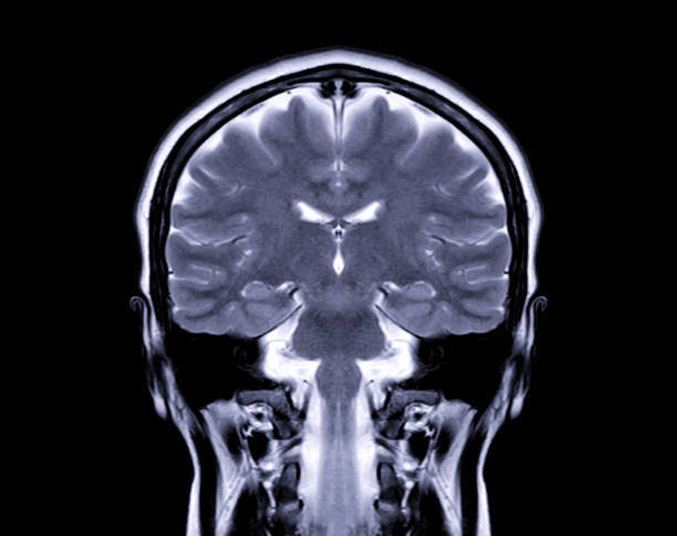 Искусственный интеллект в обработке и анализе медицинских МРТ-снимков с использованием OpenCV - _1.jpg