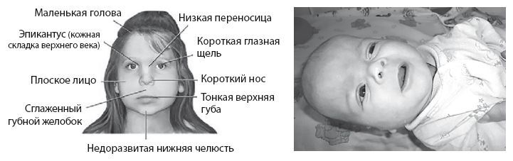 Здоровье ребенка от рождения до двух лет. Все, что нужно знать родителям об уходе за малышом - i_018.jpg