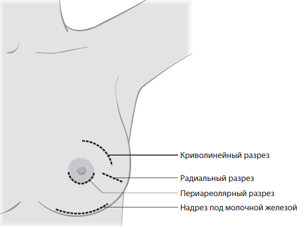 Поговорим о раке груди. Полное руководство для онкопациентов и их близких - i_005.png