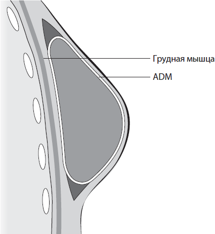 Поговорим о раке груди. Полное руководство для онкопациентов и их близких - i_017.png